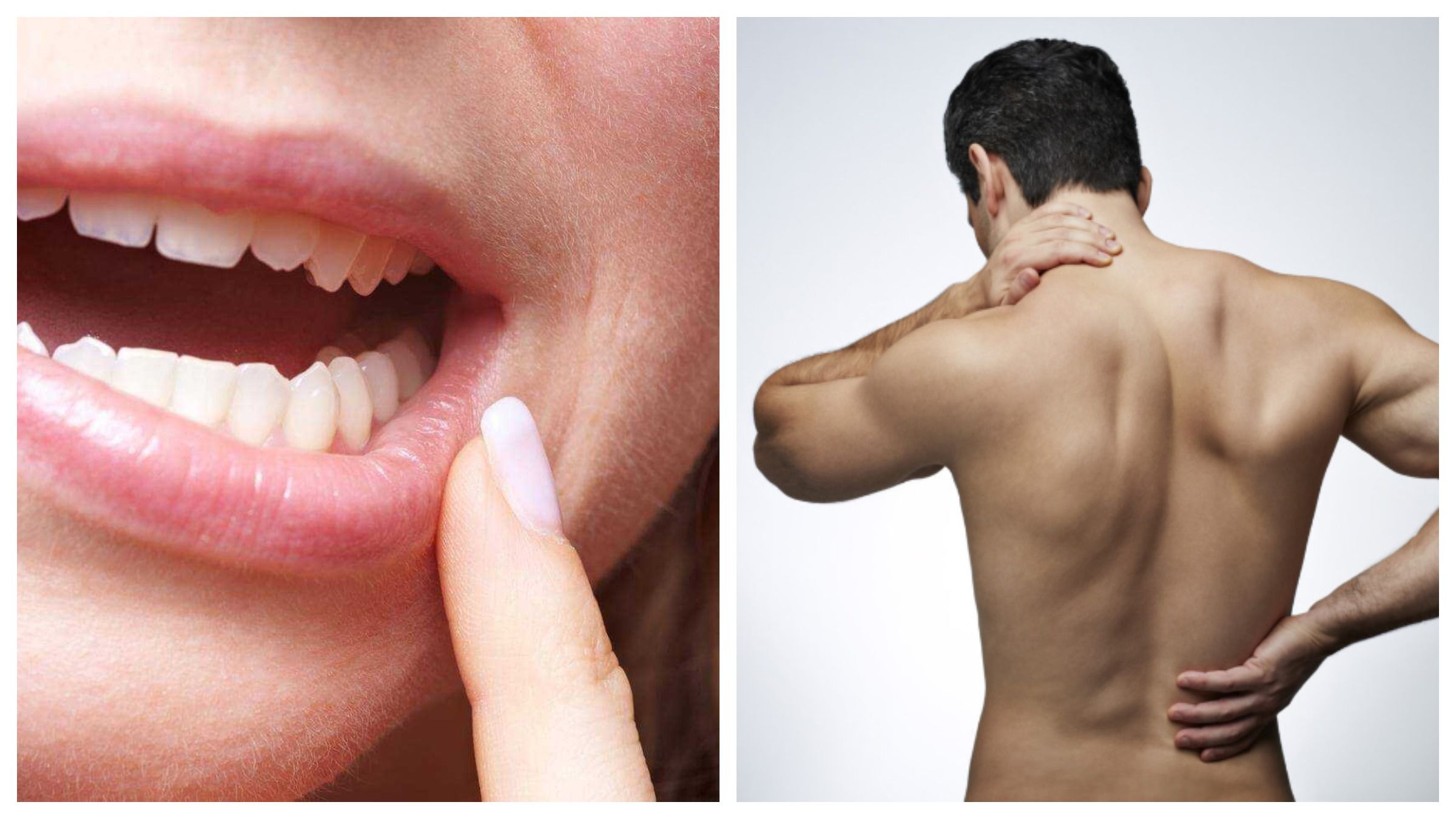 Про зуби мудрості й слабкий хребет: коли еволюція звернула не туди – 1 Про зуби мудрості й слабкий хребет: коли еволюція звернула не туди – 1