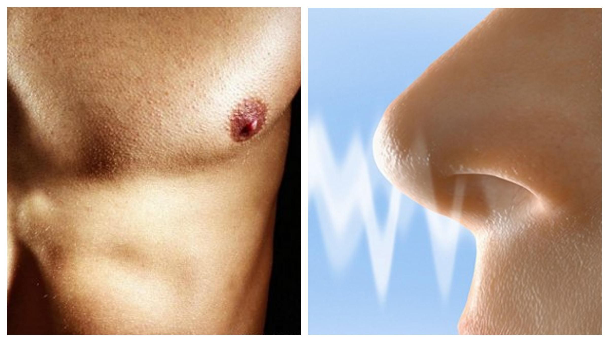 Про соски, феромони й вітамін С: коли еволюція звернула не туди – 2 Про соски, феромони й вітамін С: коли еволюція звернула не туди – 2